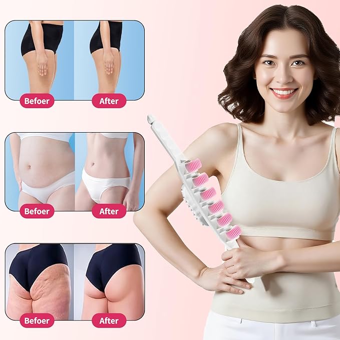 Docemel Cellulite Massage Tool for Legs,Thighs,and Arms–Lymphatic Drainage Massager for Pain Relief and Body Sculpting,Muscle Roller Stick for Circulation Support