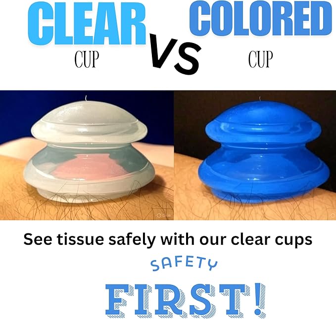 Cupping Warehouse Supreme 4 Intermediate Pro 5560 Beginner Silicone Cupping Set – 4 Cups for Body Sculpting, Massage Therapy, Pain Relief, Cellulite Reduction (S1.3, M1.6, L2.1, XL2.75)