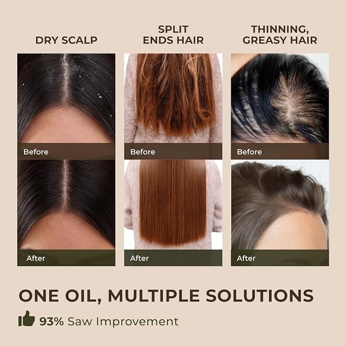 Gya Labs Peppermint Essential Oil for Diffuser & Hair - Huge 4 Fl Oz - 100% Pure Natural Peppermint Oil for Skin, Face, Body, Self-Care, Aromatherapy & Candle Making Scent