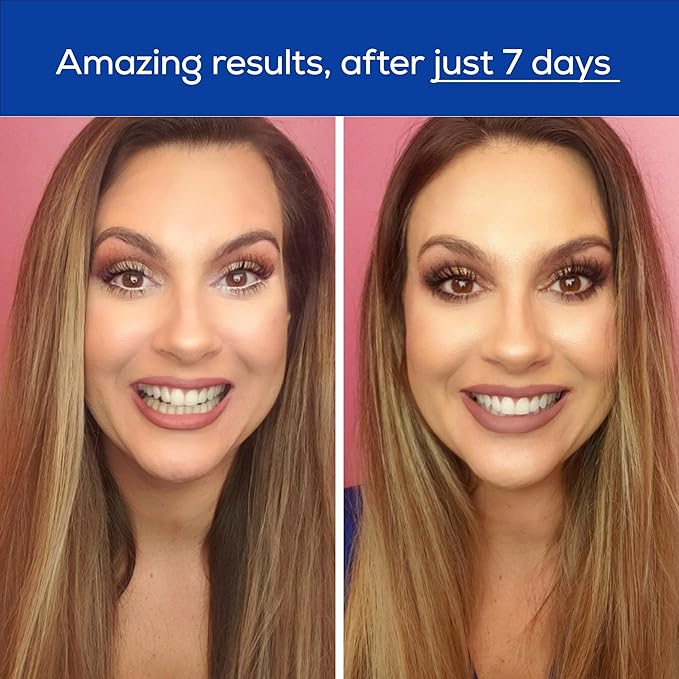 GLO Science Teeth Whitening Gel – 6% Hydrogen Peroxide – Clinically Proven, Fast & Safe for Sensitive Teeth – Includes 10 Gel Vials & 1 Lip Care